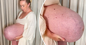 “How is That Possible?”: Mom’s Giant Baby Bump That Goes “Straight Out” Leaves People Confused
