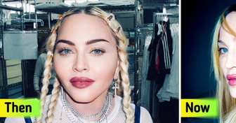 “What Have You Done to Your Face?” Madonna, 66, Unveils Bold New Look in Recent Photos