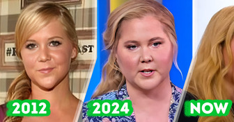 Amy Schumer Reveals Internet Trolls Helped Her Discover She Had Cushing’s Syndrome