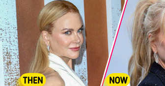 Nicole Kidman Creates Buzz with New Look — People Spot Facelift Indicators Near Her Ears