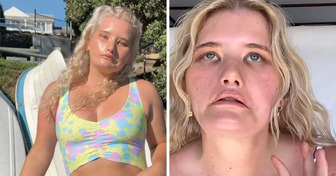 “Girl Who Can’t Smile” Turns Her Unique Story Into Modeling Success, Proving That Beauty Has No Rules
