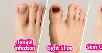 Your Body Trying to Tell You Something Through Your Toenails
