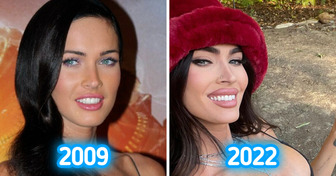 15 Celebrities Who Have Perfected Their Appearance Beyond Recognition