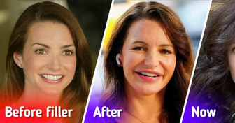 Kristin Davis, 59, Dissolved Fillers in Her Face, Leaving People in Awe