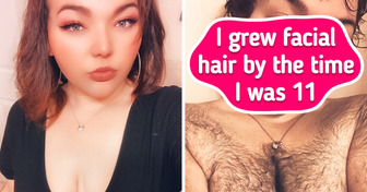 A Woman Was Critisized Because of Her Hair, but She Is Brave Enough to Show Her Honest Photos