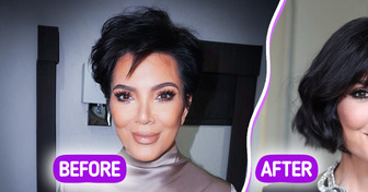 “I Want to Be the Best Version of Myself,” Kris Jenner Reveals Her Second Facelift Secrets