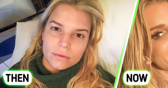 “What Did She Do to Her Lips?” Jessica Simpson’s Recent Photo Sparks Controversy Among Fans