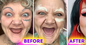 A 38-Year-Old Woman Undergone a Challenging Journey, Having to Remove Her Teeth, but Her Transformation Left People in Awe