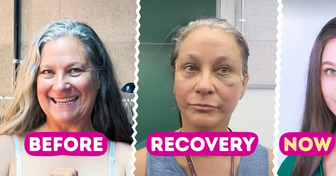 A Woman Won a Free “Mommy Makeover” in Korea — and the Results Left People Stunned