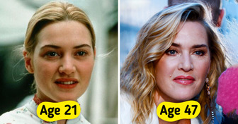 15 Celebrities Who Embrace Aging Gracefully — No Fillers Required