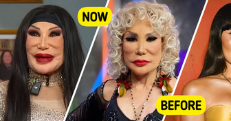 Jealousy Ruined This Mexican Star’s Face — See Her Incredible Comeback
