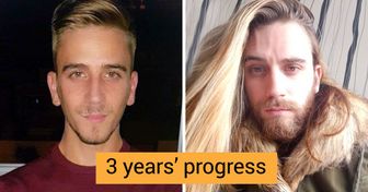 18 People Who’ve Decided to Show Their Astonishing Hair Growth Progress