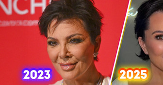 “Best Facelift!” Kris Jenner’s Amazing Surgery Reveal Has Everyone Talking