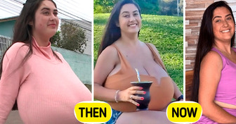 After Removing 10kg (22lbs), She Finally Feels Like Herself Again