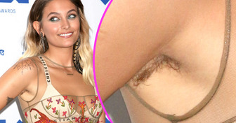 15 Celebrities Who Smashed the Beauty Standards and Are Not Ashamed to Flaunt Their Body Hair