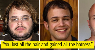 15 People Showed How Shockingly Time Can Make Difference and Open Up Uniqueness