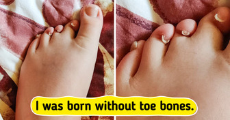 14 People With Truly Unique Features That Instantly Grab Attention