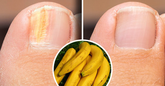 12 Tips for Healthy, Strong Nails | Facts About Your Nails That Will Help You Treat Them Better