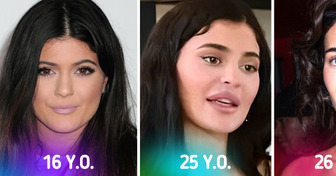 «You Look Like 50.» People Are Accusing Kylie Jenner of Excessive Plastic Surgery and Filters