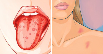 10+ Red Flags Your Body Raises When You Might Be Low in Iron