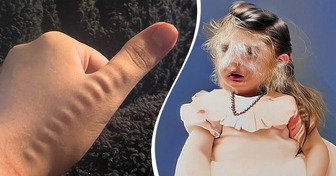 15 People with Unique Body Traits That Caught Us Off Guard