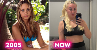 14 Celebrities Whose Appearance Has Evolved Over the Past Decade