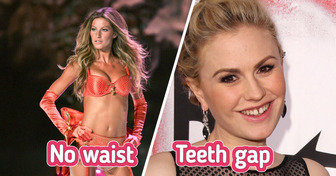 8 Celebrities Who Proudly Embrace Their Unique Features