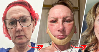 13 Photos Where “Before” and “After” Feel Like Different Universes