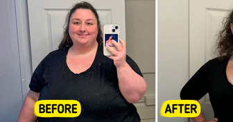 20+ Before & After Photos That Prove Miracles Are Real
