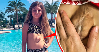 Meet a Girl Who Was Born With Her Heart Outside Her Chest, Defying Doctors Who Gave Her No Chance to Live