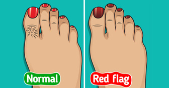 11 Surprising Health Clues Your Feet Might Be Trying to Tell You