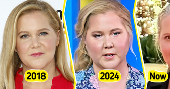 Amy Schumer’s New Look Sparks Buzz — People Can’t Stop Talking About Her Legs