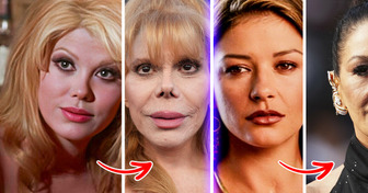 10 Celebrities Whose Dramatic Transformations Over Time Left Us Speechless
