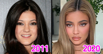 18 Celebs Who Look Like Totally New People Now