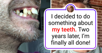13 People Reveal Their Glow-Up Secrets — The Results Speak for Themselves
