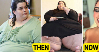 “My 600-lb Life” Star Who Lost 377 Pounds Reveals Stunning New Look That Leaves People Speechless