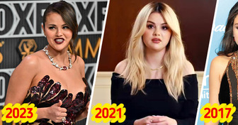 Some People Claimed Selena Gomez “Biggest Victim Player in the World,” as She Revealed She Will Never Have Body Like Before