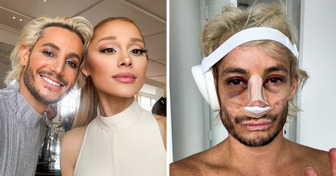 Ariana Grande Opens Up About Her Reaction to Her Brother’s Nose Surgery