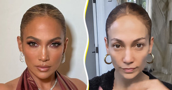 11 Unfiltered Celebrity Pics That Show Stars Are Human Too