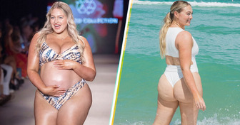 “I Saw My Body as the Enemy,” Body-Positive Model Reveals How She Transformed Self-Hate Into Self-Love