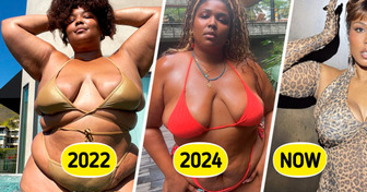 Lizzo Proudly Shows Off Her Slimmed-Down Body in Cheeky Photos, Leaving People Buzzing About the Same Detail