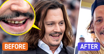 Johnny Depp, 61, Stuns Fans with Drastic New Smile After Years of “Rotten” Teeth