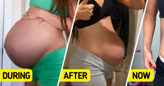 People Were Convinced That This Mom’s Huge Bump Was Fake Until She Showed Her Postpartum Belly