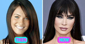 20 Famous People Who Remarkably Transformed Their Appearance Throughout the Years