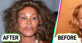 “Catwoman” Jocelyn Wildenstein Shares Rare Photo Revealing How She Used to Look Before Transformations