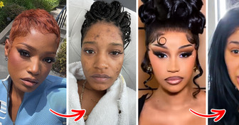 15+ Celebrities Who Bravely Showed Their Real Faces