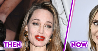 “She Never Looks Healthy,” Angelina Jolie’s Changed Look Sharply Divides People