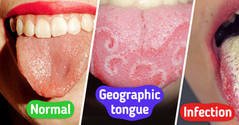 Your Tongue Can Alert You to Health Problems