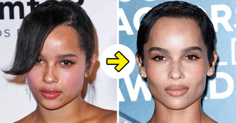 15 Famous Women Who Got Chiselled Cheekbones Instead of Chubby Cheeks