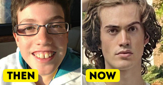 15 People Whose Transformation Through the Years Will Shock You